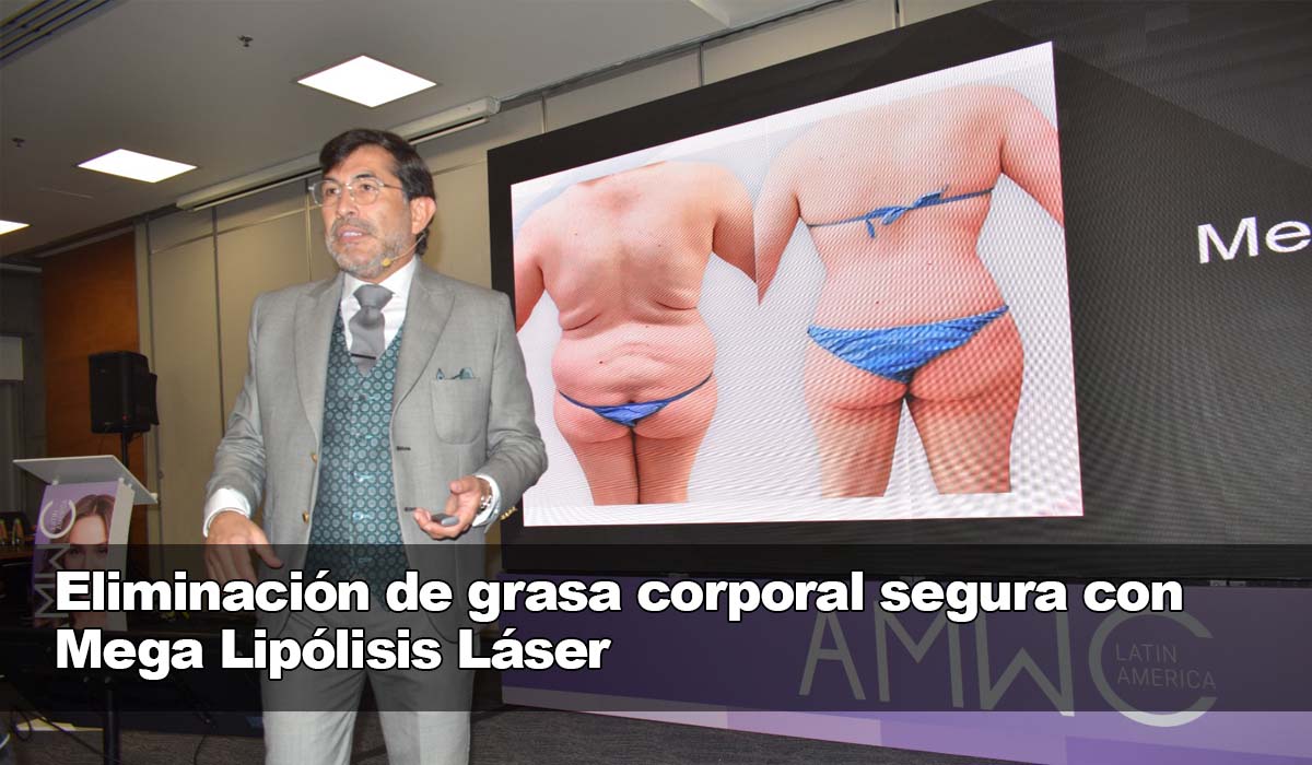 Deshazte de la grasa corporal de forma segura con Mega Lipólisis Láser