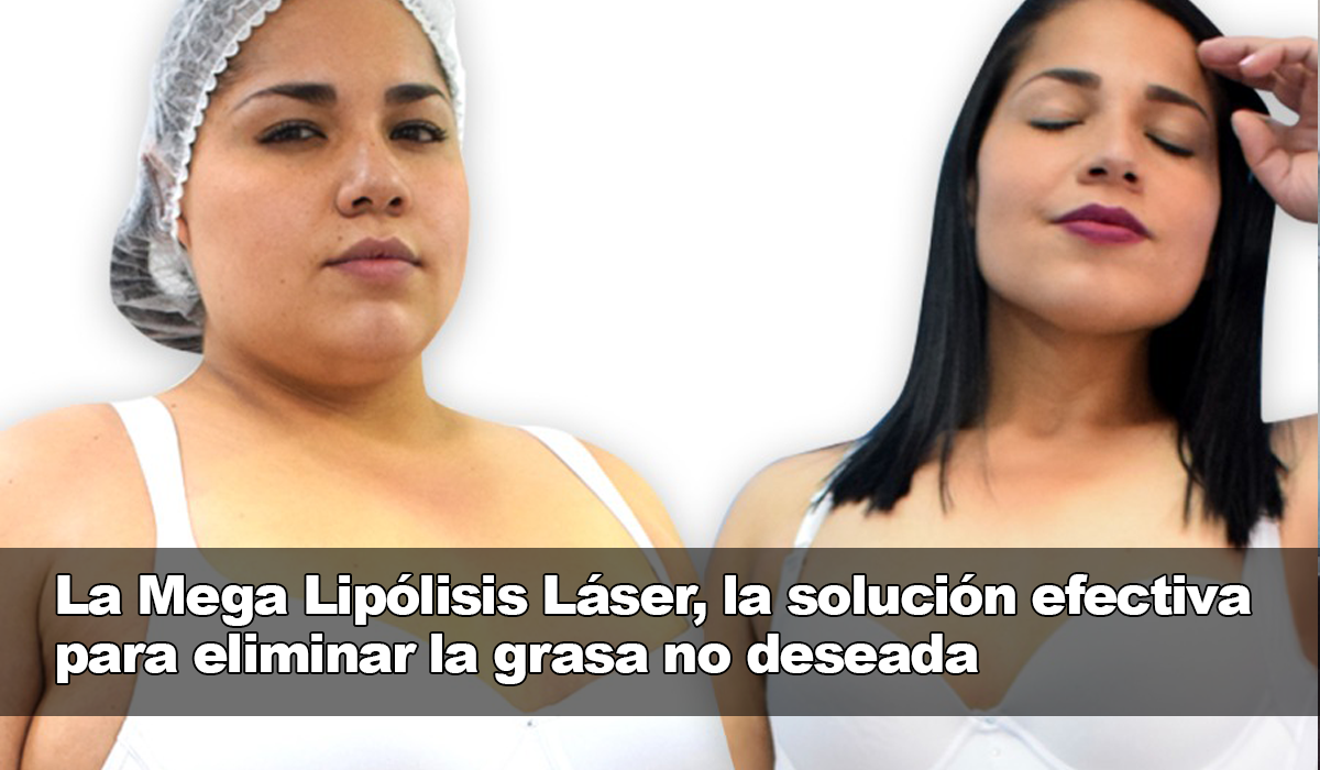 La Mega Lipólisis Láser, la mejor solución para disminuir la grasa sin problemas